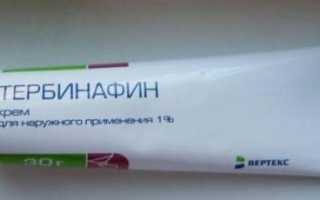 Грибок на пальцах ног: симптомы, как и чем лечить