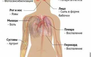 Если ушиб палец на руке: что делать и как лечить в домашних условиях?