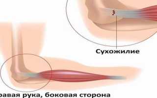 Операции при повреждениях сухожилий на кисти. типичные механизмы повреждений сухожилий пальцев кисти