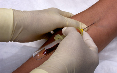 Анализ крови