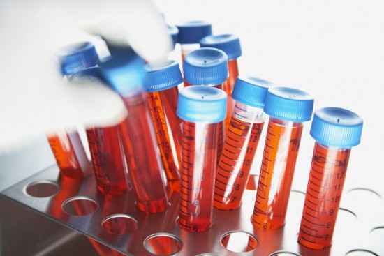 Анализ крови