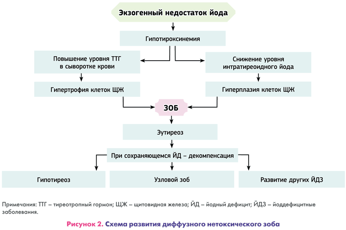 Схема развития диффузного нетоксического зоба