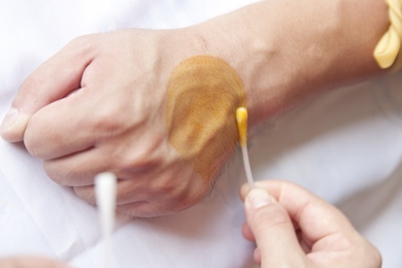 Тест на йододефицит