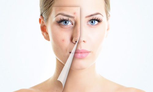 Угревая сыпь на лице