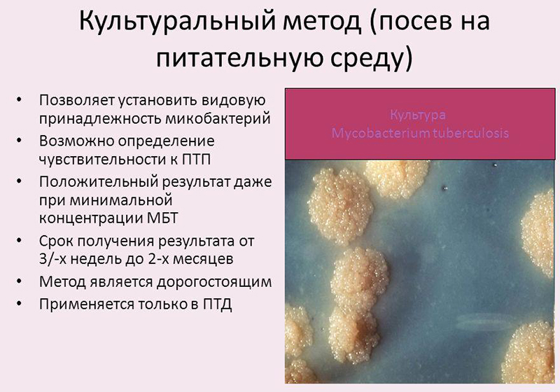 Анализ культулярный для выявления пиелонефрита Анализ культулярный