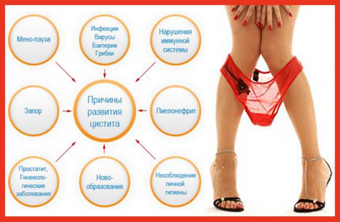 Причина цистита Какая причина цистита у женщин