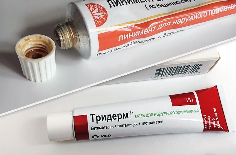 Наружные средства для лечения цистита Мази для лечения цистита
