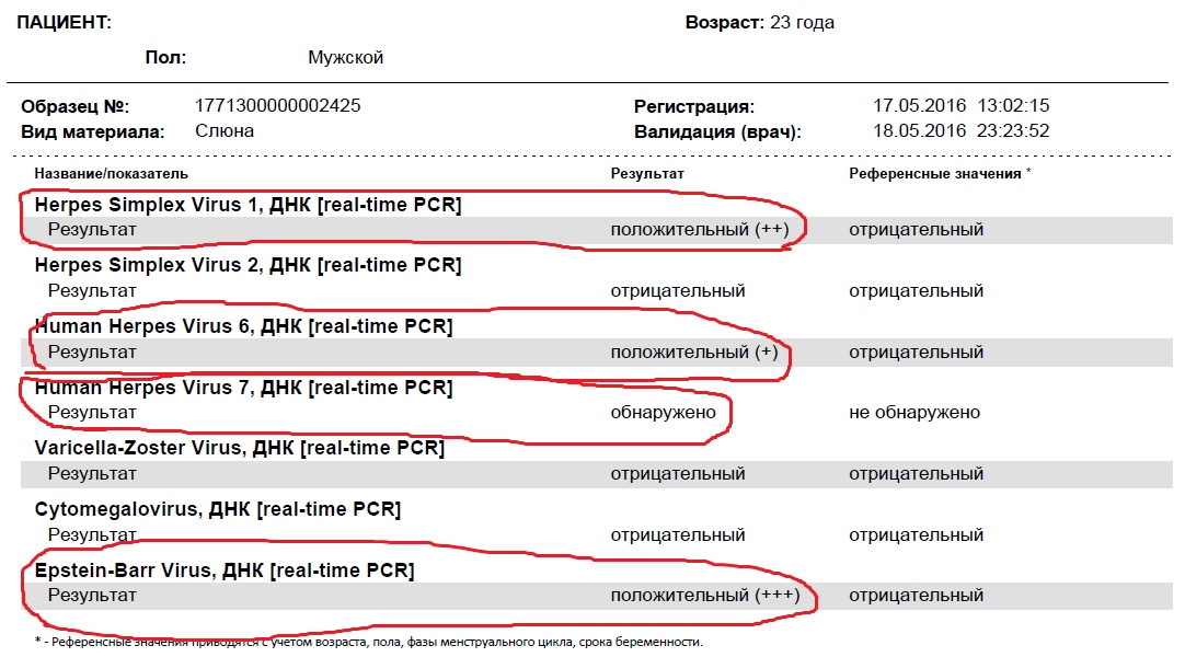 Пример анализа слюны на выявление проблем МПС Пример анализа