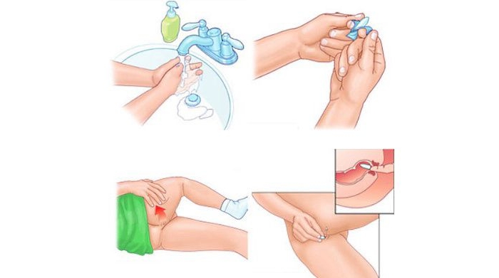 Как пользоваться свечами Как правильно пользоваться свечами