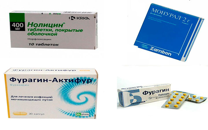 Как лечить цистит у женщин Какие препараты помогут при цистите