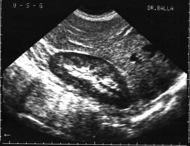 Лучевая диагностика Мочекаменной болезни Лучевая диагностика