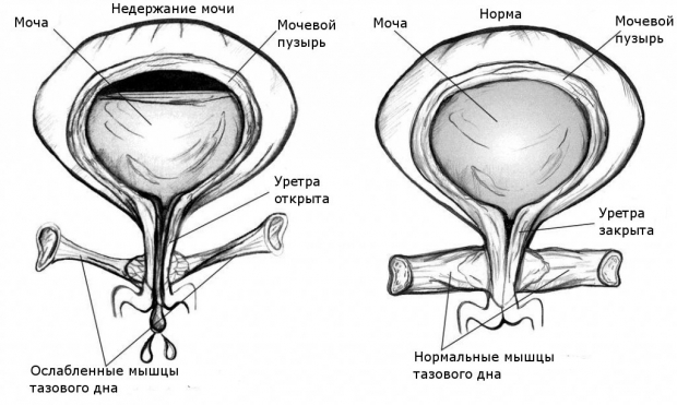 Причины возникновения заболевания Какие причины заболевания