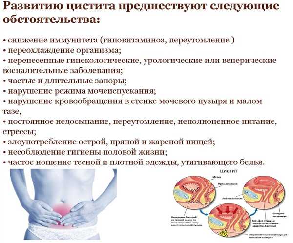 Причины цистита при беременности Причины цистита