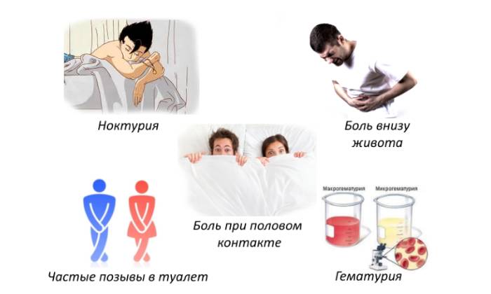 Какие симптомы недержания мочи у мужчин Какие симптомы недержания мочи