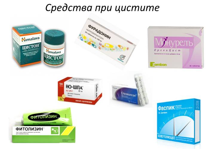 Какие медикаменты помогают при цистите Какие средства помогают при цистите