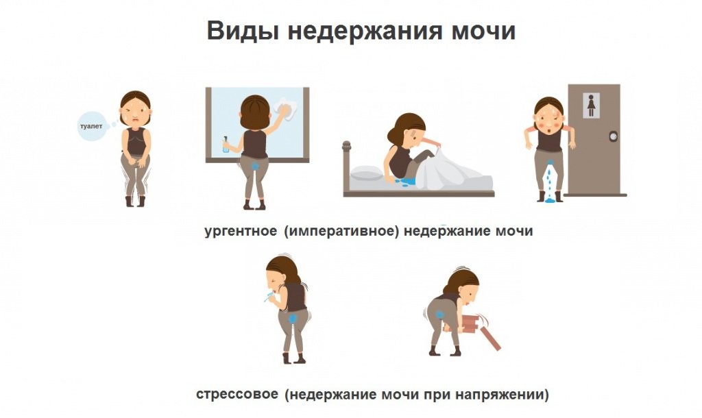 Виды энуреза у взрослых Виды энуреза