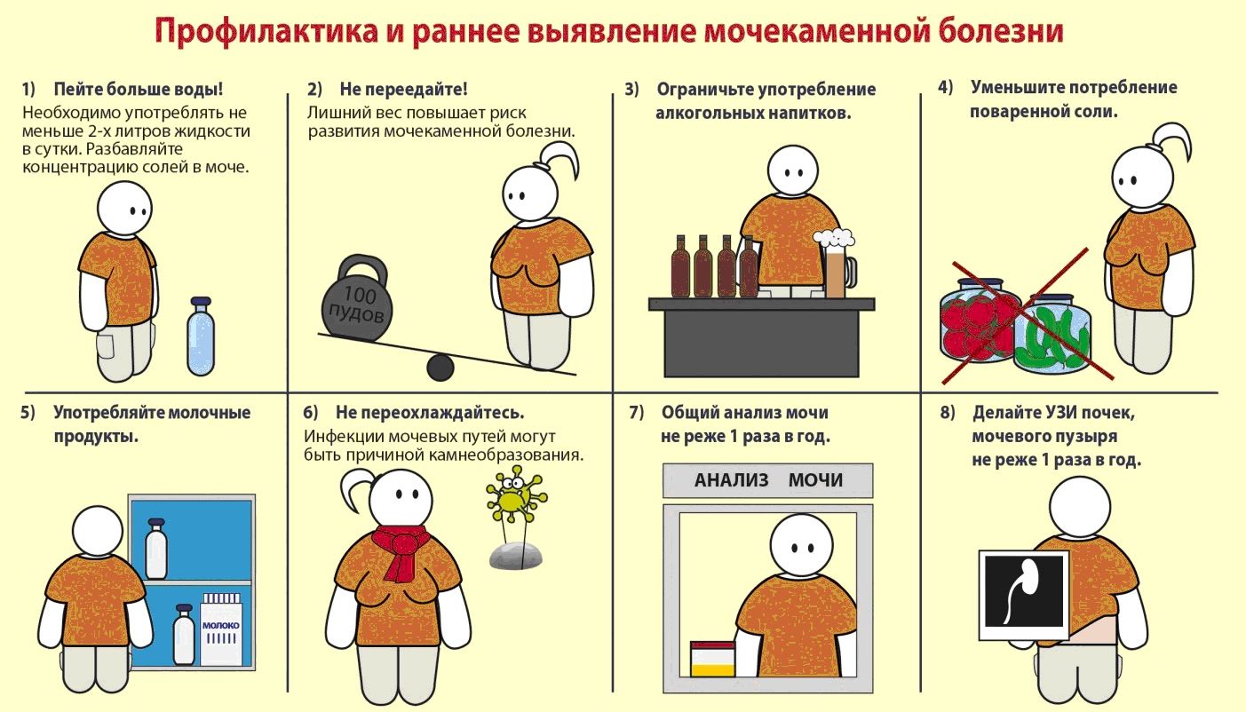 Что делать для профилактики мочекаменной болезни Что делать