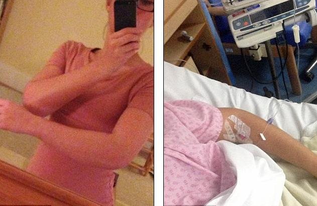 Результат болезни рабдомиолиза Результат рабдомиолиза