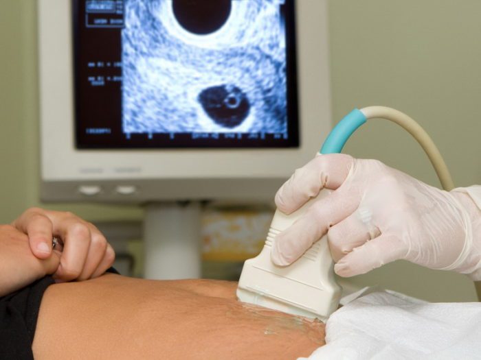 Как выявить пиелонефрит у пациента Как выявить пиелонефрит