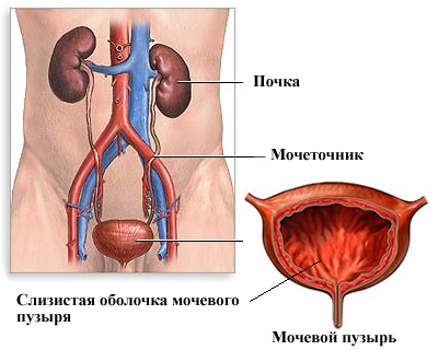 МПМ система у мужчин МПМ система