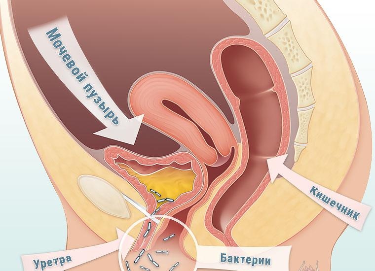 Одна из причин заболеваний является бактериальной Одна из причин заболеваний