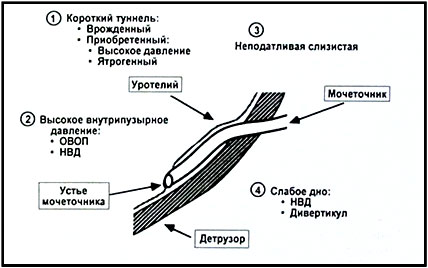 Причины заболевания Пузырно-мочеточниковый рефлюса Причины заболевания