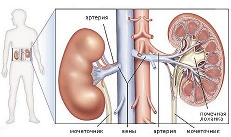 Как выражается заболевание пиелонефрит строение почки