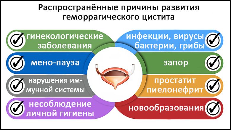 Причины геморрагического цистита у женщин Причины геморрагического цистита