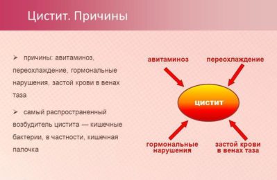 Какие причины заболевания острого цистита Какие причины острого цистита