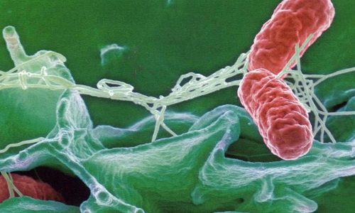 Причины заражения Уреаплазмозы Причины заражения