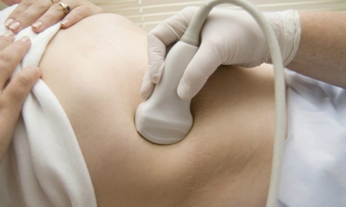 Процедура диагностирования МКБ Процедура диагностирования