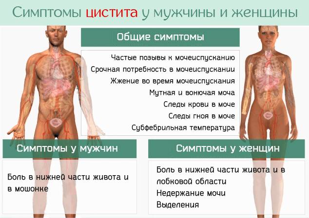 Симптомы цистита у мужчин и женщин Симптомы цистита