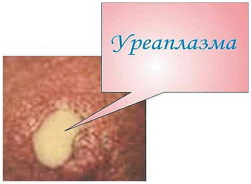 Внешний вид уреаплазмы уреаплазма