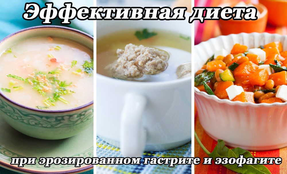 Диетическое питание при эрозированном гастрите и эзофагите Диетическое питание при эрозированном гастрите и эзофагите