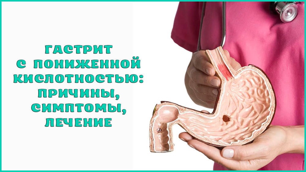 Гастрит с низкой кислотностью Гастрит с низкой кислотностью