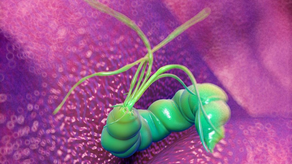 Helicobacter pylori Helicobacter pylori